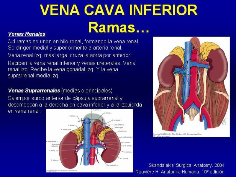 Diapositiva 16 de Anatomía grandes vasos abdominales 2