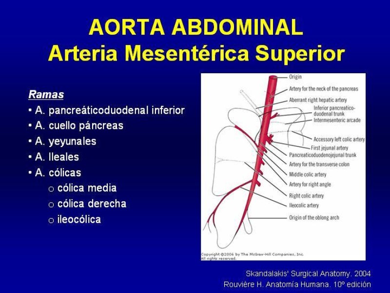 Diapositiva 21 de Anatomía grandes vasos abdominales