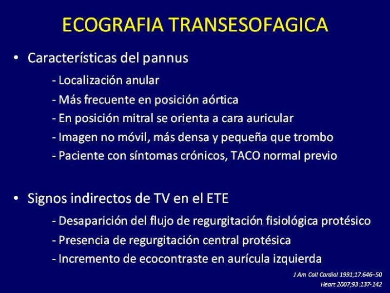 Diapositiva 21 de Trombosis de válvulas protésicas
