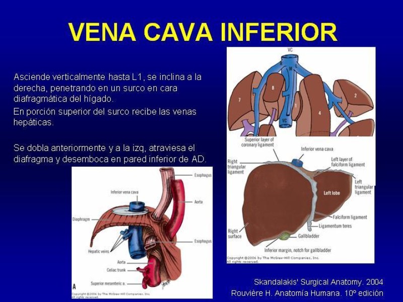 Diapositiva 10 de Anatomía grandes vasos abdominales 2