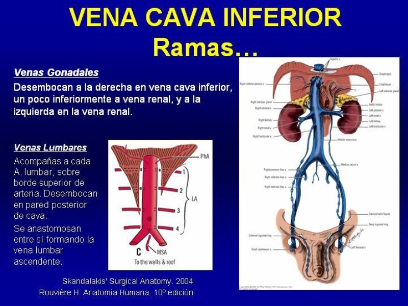 Diapositiva 17 de Anatomía grandes vasos abdominales 2