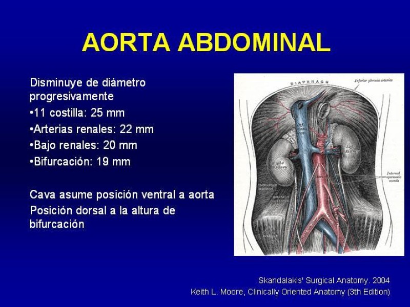Diapositiva 6 de Anatomía grandes vasos abdominales