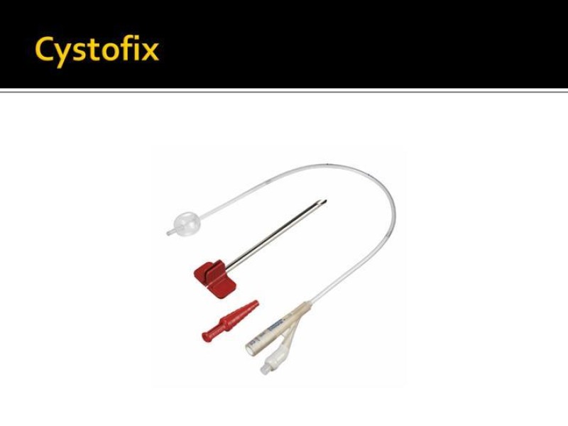 Diapositiva 6 de Cistostomías
