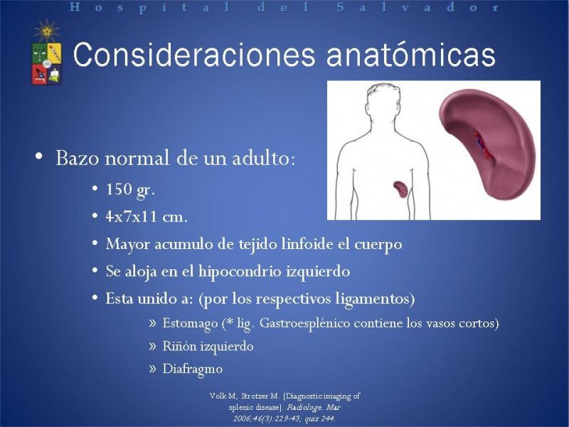 Diapositiva 16 de Abscesos Esplénicos