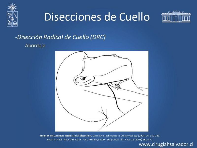 Diapositiva 13 de Disecciones ganglionares de cuello