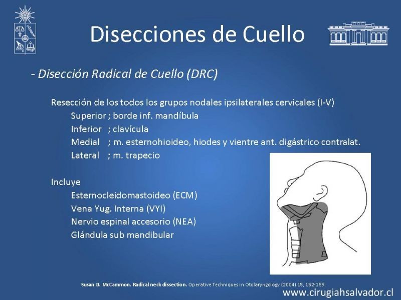Diapositiva 11 de Disecciones ganglionares de cuello