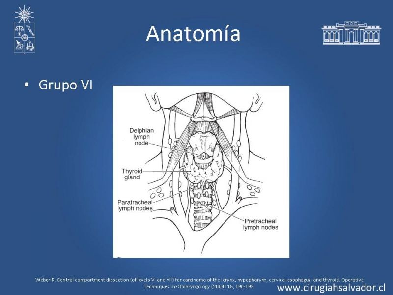 Diapositiva 7 de Disecciones ganglionares de cuello