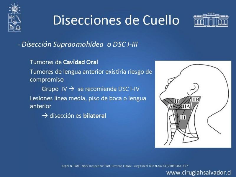 Diapositiva 17 de Disecciones ganglionares de cuello