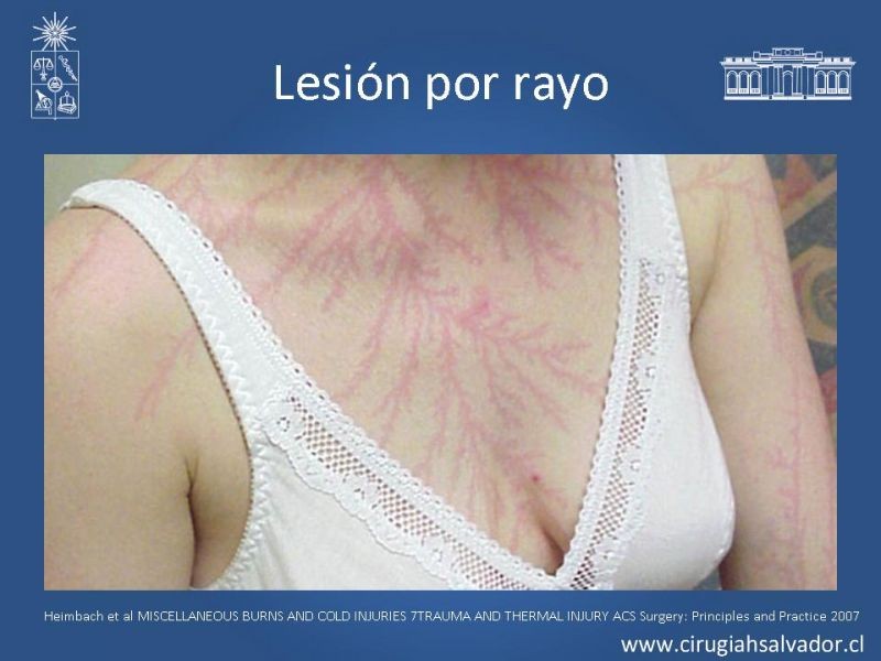 Diapositiva 26 de Lesiones Eléctricas Severas