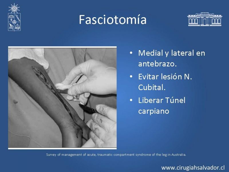 Diapositiva 44 de Lesiones Eléctricas Severas