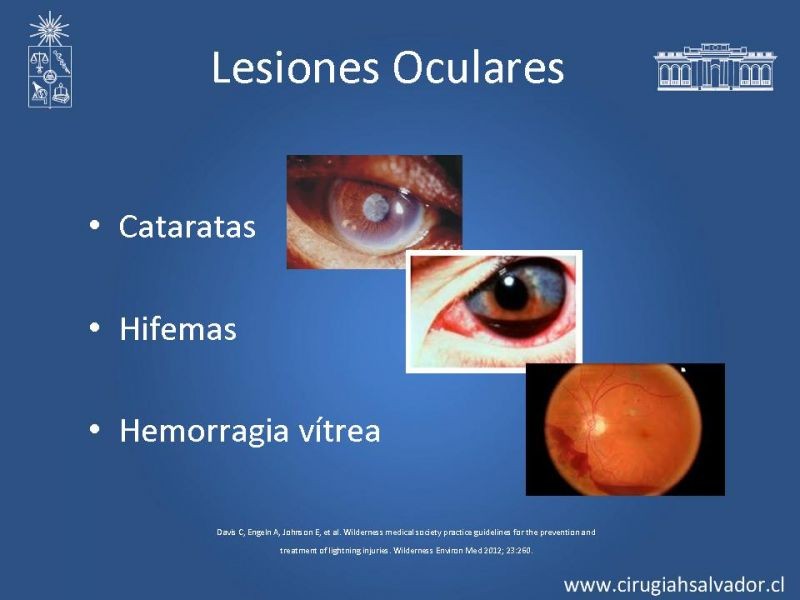 Diapositiva 22 de Lesiones Eléctricas Severas