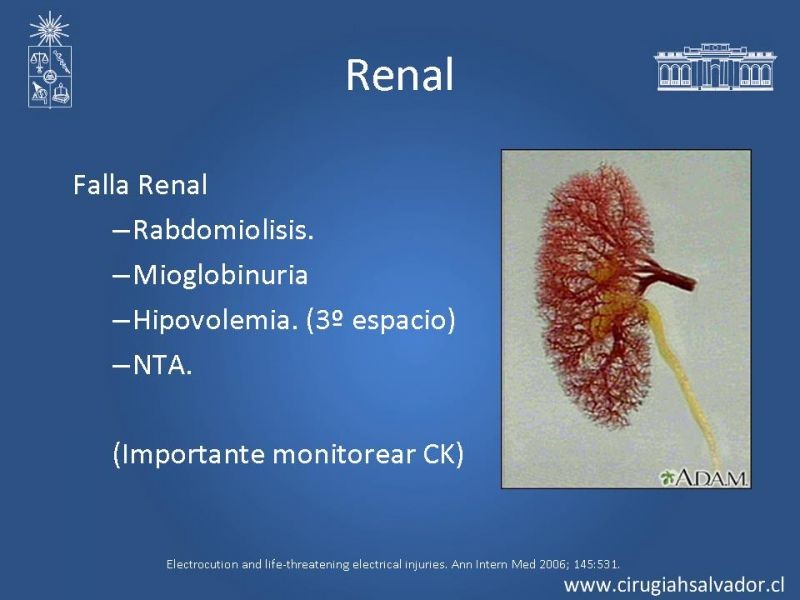 Diapositiva 20 de Lesiones Eléctricas Severas