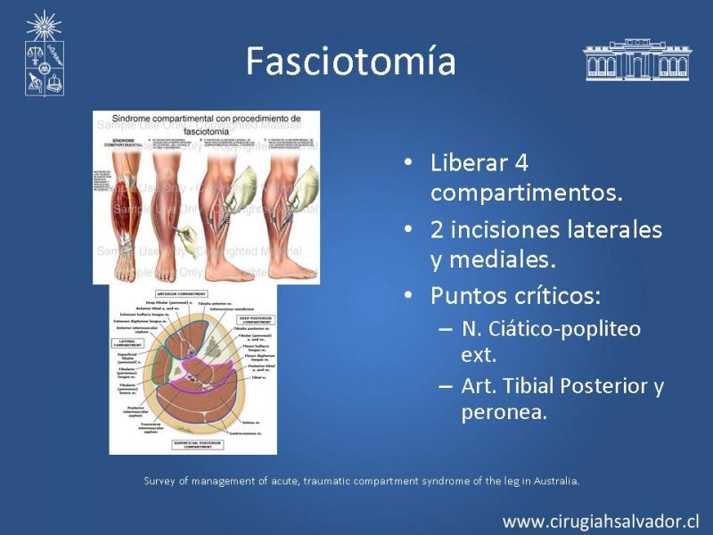 Diapositiva 45 de Lesiones Eléctricas Severas