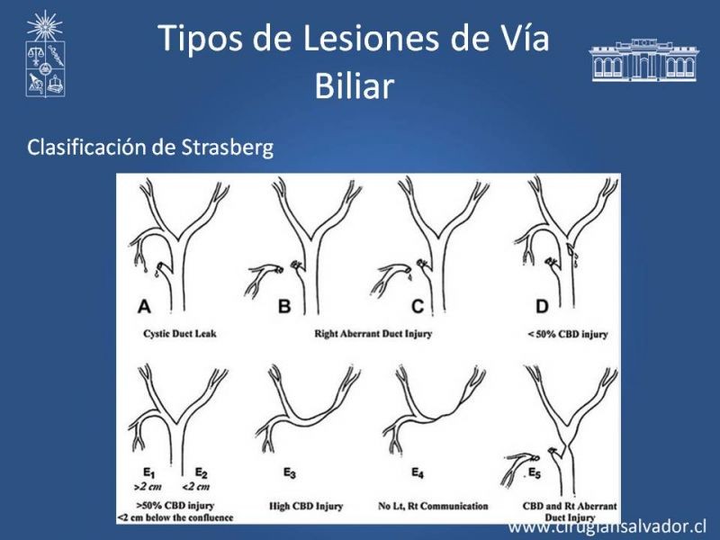 Diapositiva 6 de Prevención de Lesión Via Biliar en Colecistectomía 