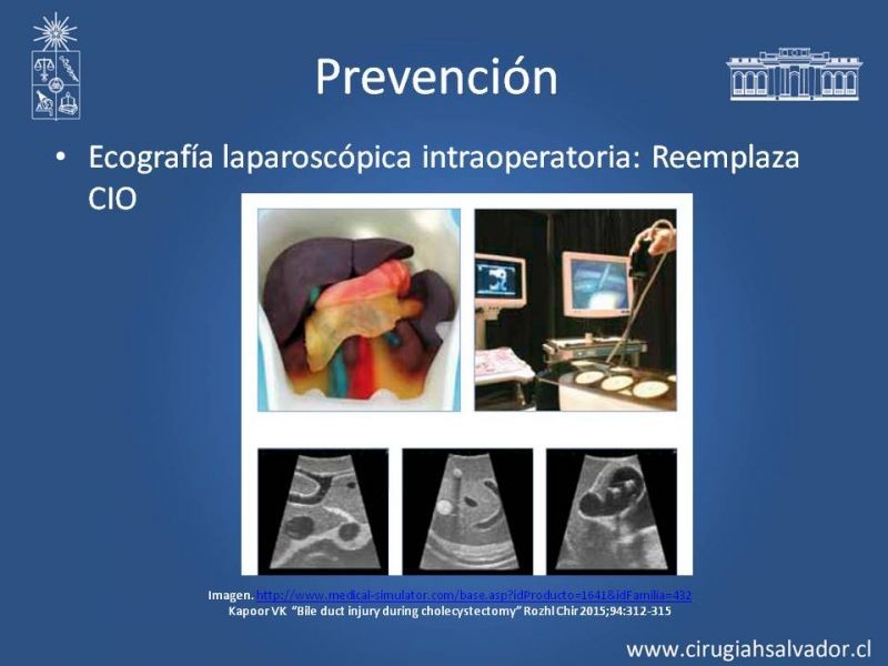 Diapositiva 12 de Prevención de Lesión Via Biliar en Colecistectomía 