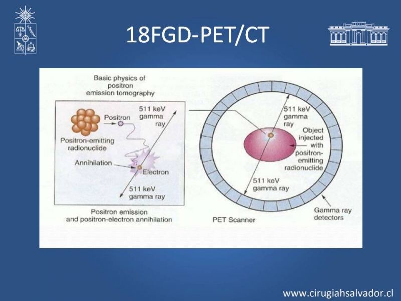 Diapositiva 5 de Utilidad de PET en cáncer de tiroides