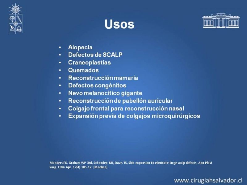 Diapositiva 5 de Expansores de Tejido