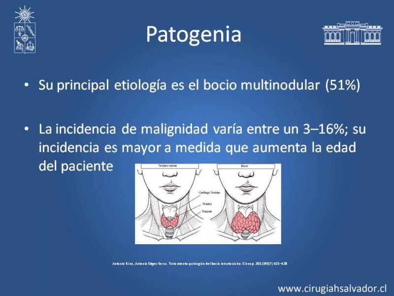 Diapositiva 5 de Bocio intratorácico