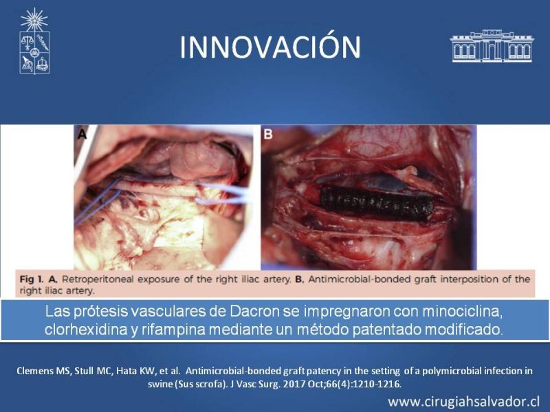 Diapositiva 40 de Infección de prótesis vasculares