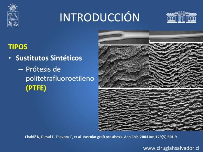 Diapositiva 5 de Infección de prótesis vasculares