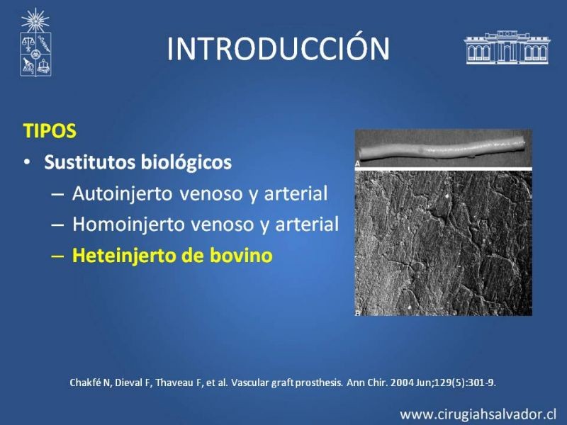 Diapositiva 4 de Infección de prótesis vasculares