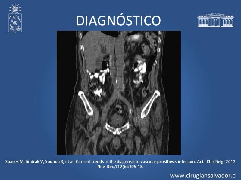 Diapositiva 29 de Infección de prótesis vasculares