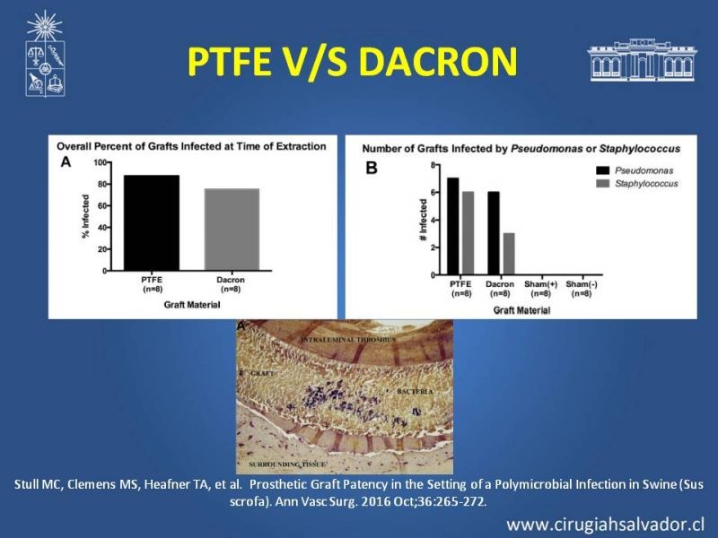Diapositiva 19 de Infección de prótesis vasculares