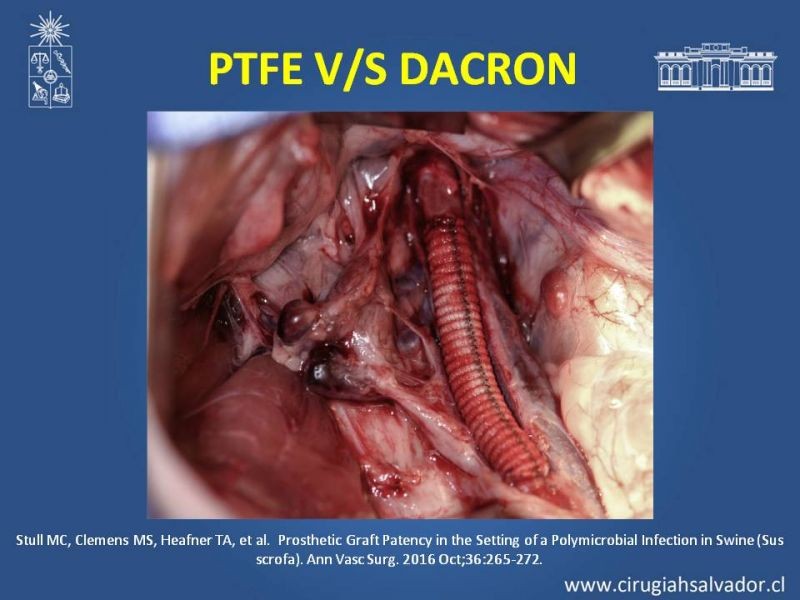 Diapositiva 16 de Infección de prótesis vasculares