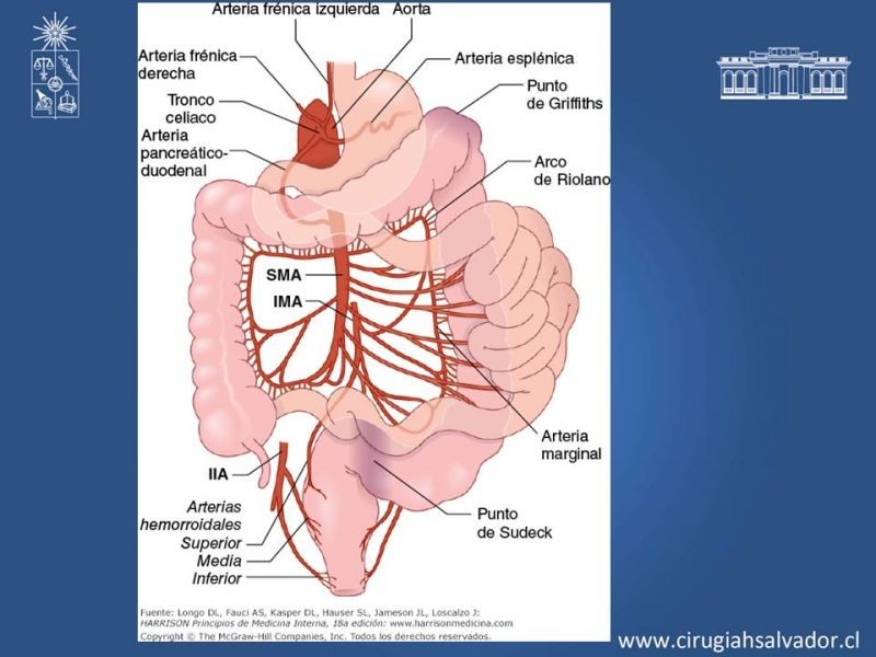 Diapositiva 4 de Isquemia mesentérica