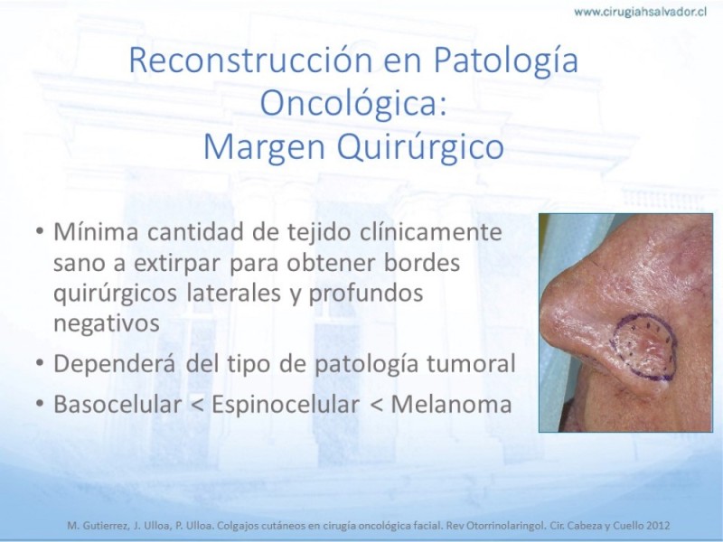 Diapositiva 7 de Tipos de Reconstrucción Facial