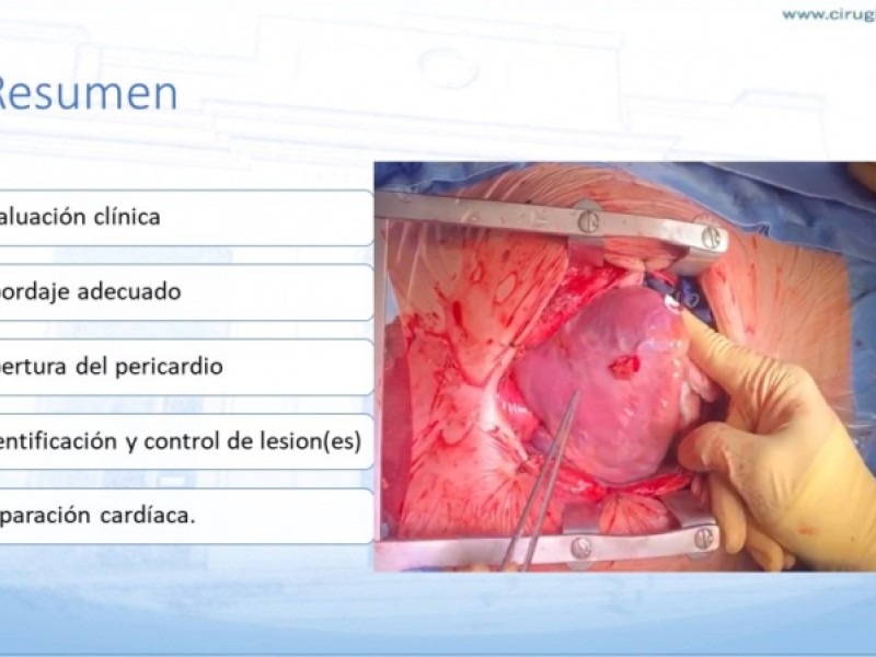 Diapositiva 26 de Trauma penetrante cardíaco