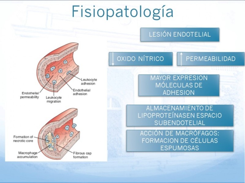 Diapositiva 4 de Tratamiento Endovascular de EAO Femoro-Distal