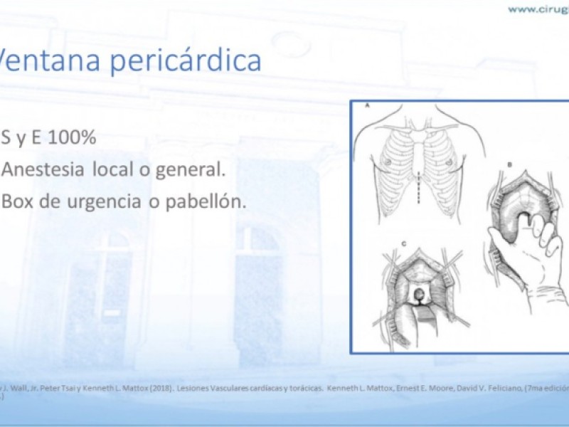 Diapositiva 13 de Trauma penetrante cardíaco