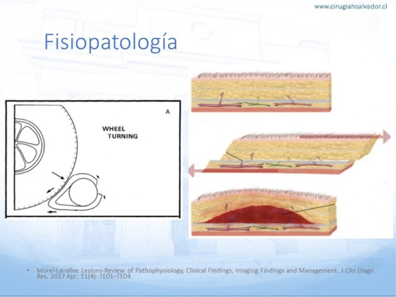 Diapositiva 3 de Desforramiento EEII