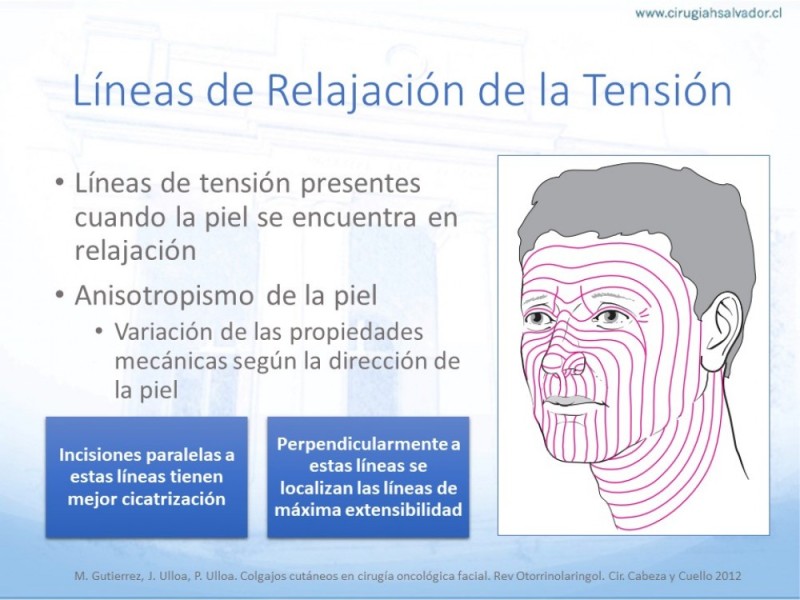 Diapositiva 11 de Tipos de Reconstrucción Facial