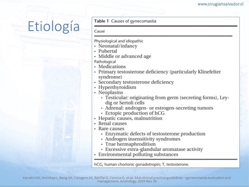 Diapositiva 6 de Ginecomastia