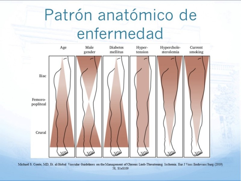 Diapositiva 6 de Tratamiento Endovascular de EAO Femoro-Distal