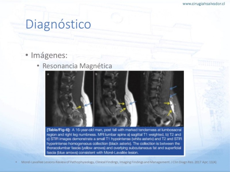 Diapositiva 7 de Desforramiento EEII