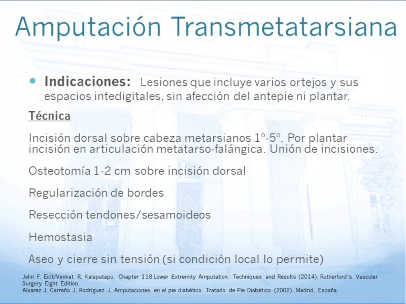 Diapositiva 10 de Técnica Quirúrgica Amputaciones Menores