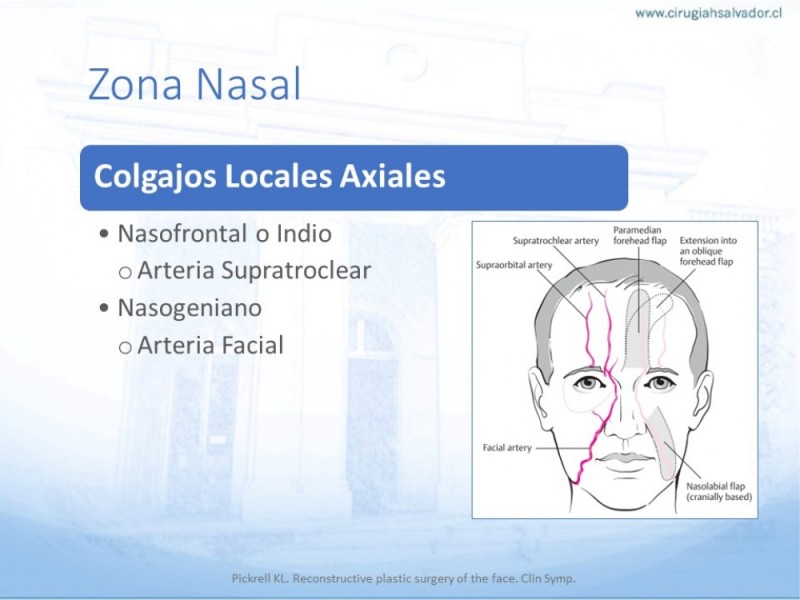 Diapositiva 31 de Tipos de Reconstrucción Facial
