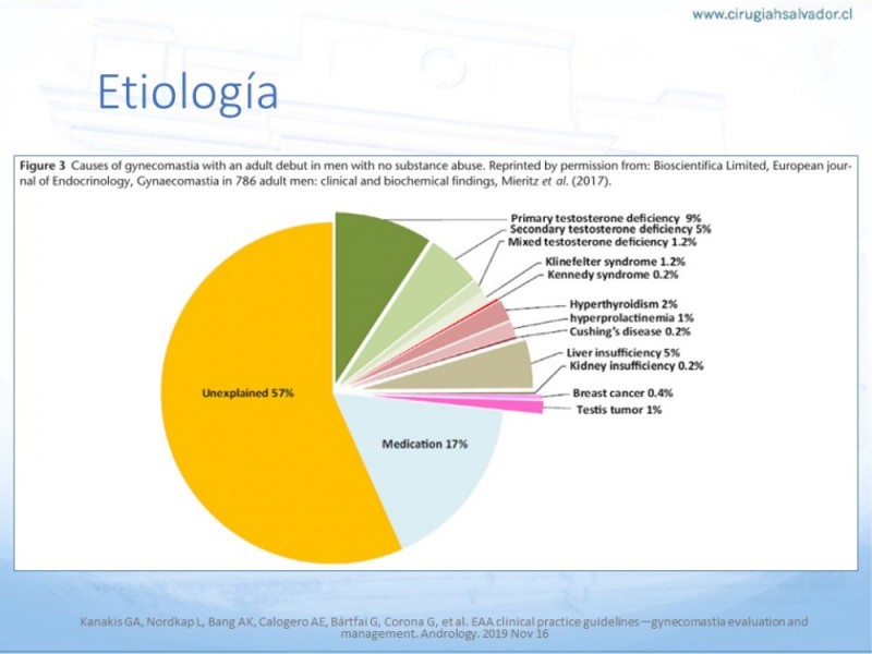 Diapositiva 7 de Ginecomastia