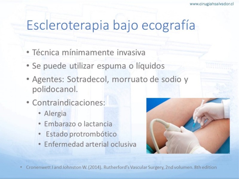 Diapositiva 16 de Safenectomía: Técnica y resultados a largo plazo