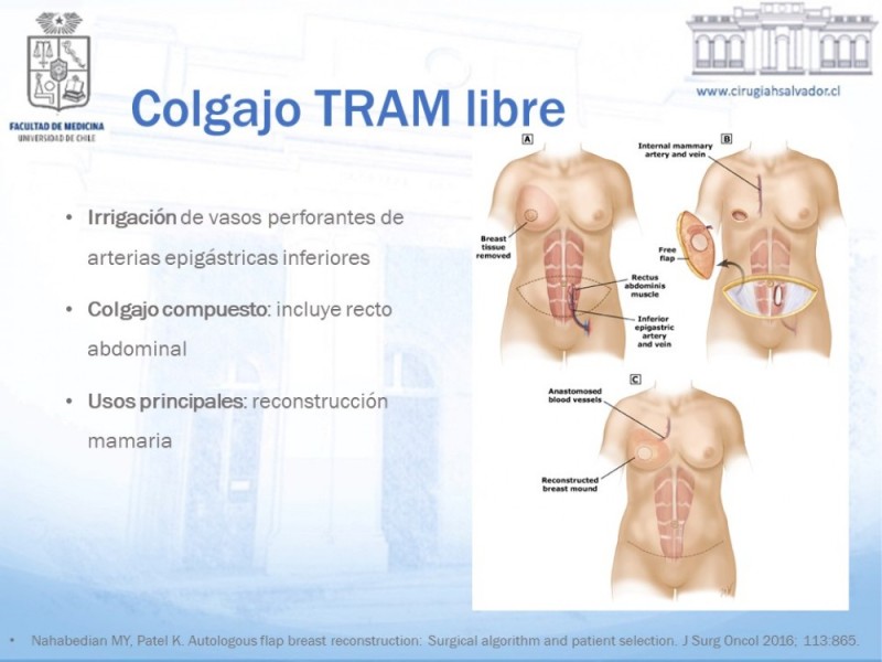 Diapositiva 13 de Colgajos MicroquirúrgicosColgajos Microquirúrgicos