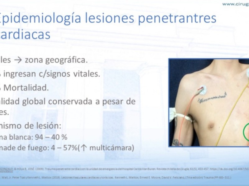 Diapositiva 4 de Trauma penetrante cardíaco