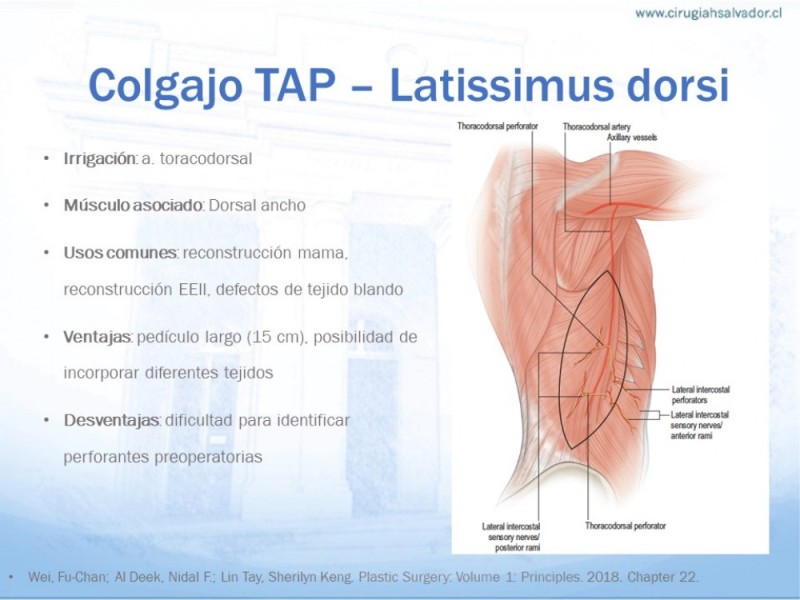 Diapositiva 14 de Colgajos MicroquirúrgicosColgajos Microquirúrgicos