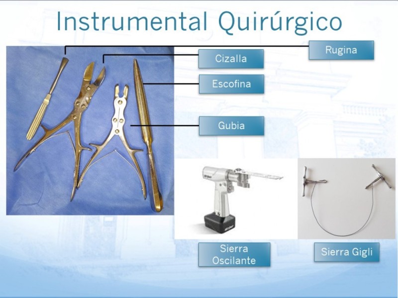 Diapositiva 4 de Técnica Quirúrgica Amputaciones Menores
