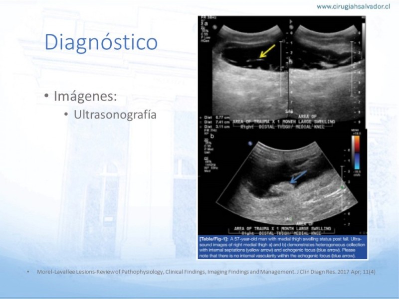 Diapositiva 5 de Desforramiento EEII
