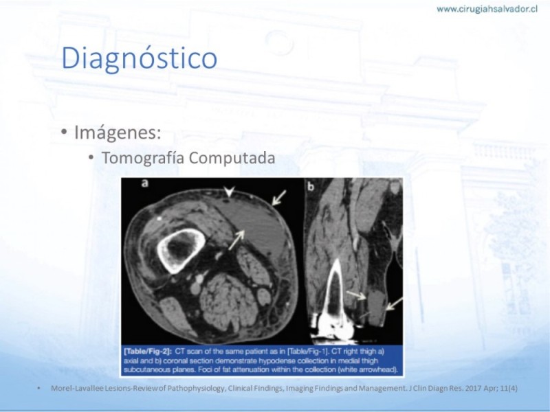 Diapositiva 6 de Desforramiento EEII