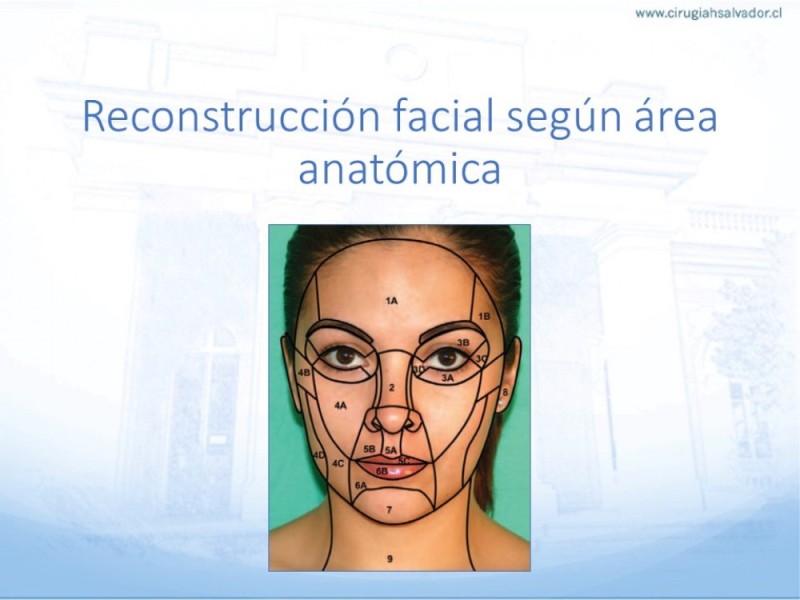 Diapositiva 13 de Tipos de Reconstrucción Facial