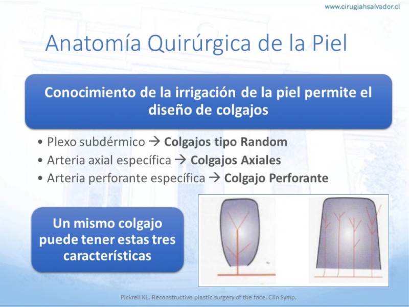 Diapositiva 9 de Tipos de Reconstrucción Facial